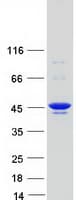 Human RRM2 Protein (Recombinant Myc-DDK (Flag))