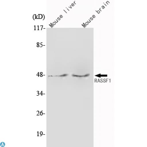 RASSF1 / RASSF1A Antibody
