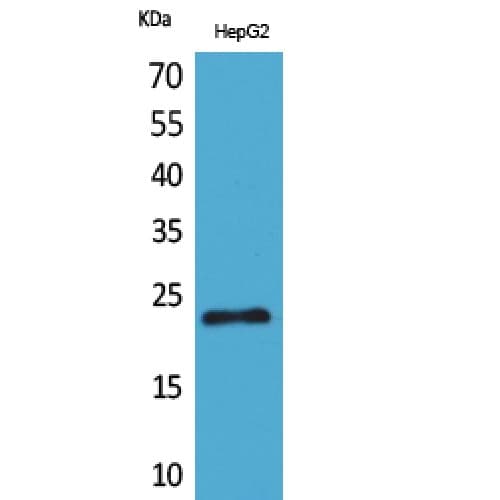 Polyclonal Rabbit anti-Human SNAP23 / SNAP-23 Antibody (C-terminal, WB)