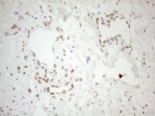 PELI1 / Pellino 1 Antibody (aa1-245, clone OTI13F8)