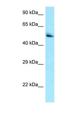 PANK2 Antibody (aa459-508)