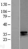 Human UCP3 Protein (Over-Expression Lysate Myc-DDK (Flag))