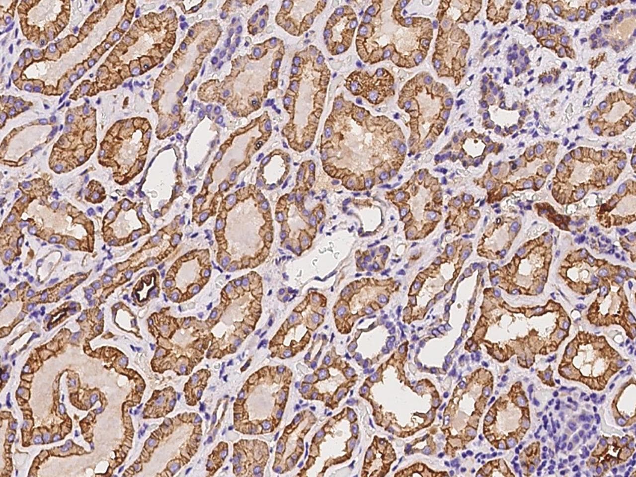 SLC12A1 / NKCC2 Antibody