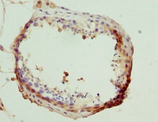 Polyclonal Rabbit anti-Human MLLT3 / AF9 Antibody (IHC)