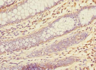 Polyclonal Rabbit anti-Human KHK / Ketohexokinase Antibody (IHC, WB)