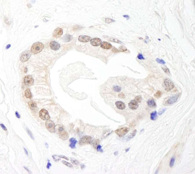 Polyclonal Rabbit anti-Human BRF1 Antibody (aa550-600, IHC, WB)