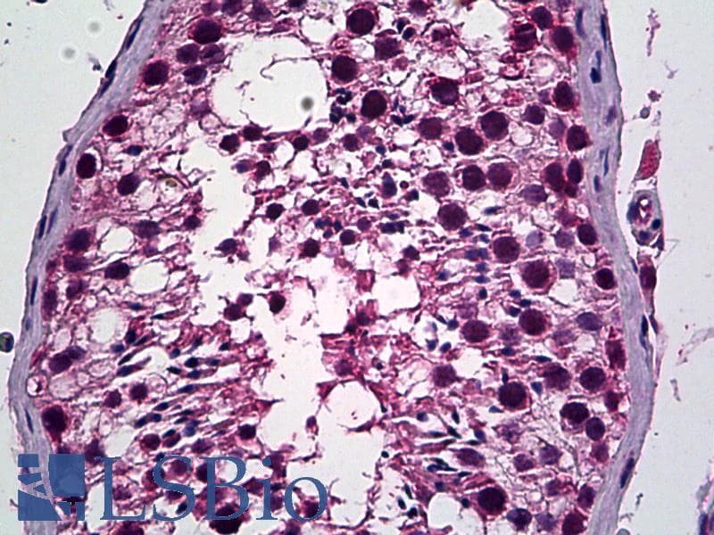 IHC-plus™ PREX1 / P-REX1 Antibody (aa1514-1526)