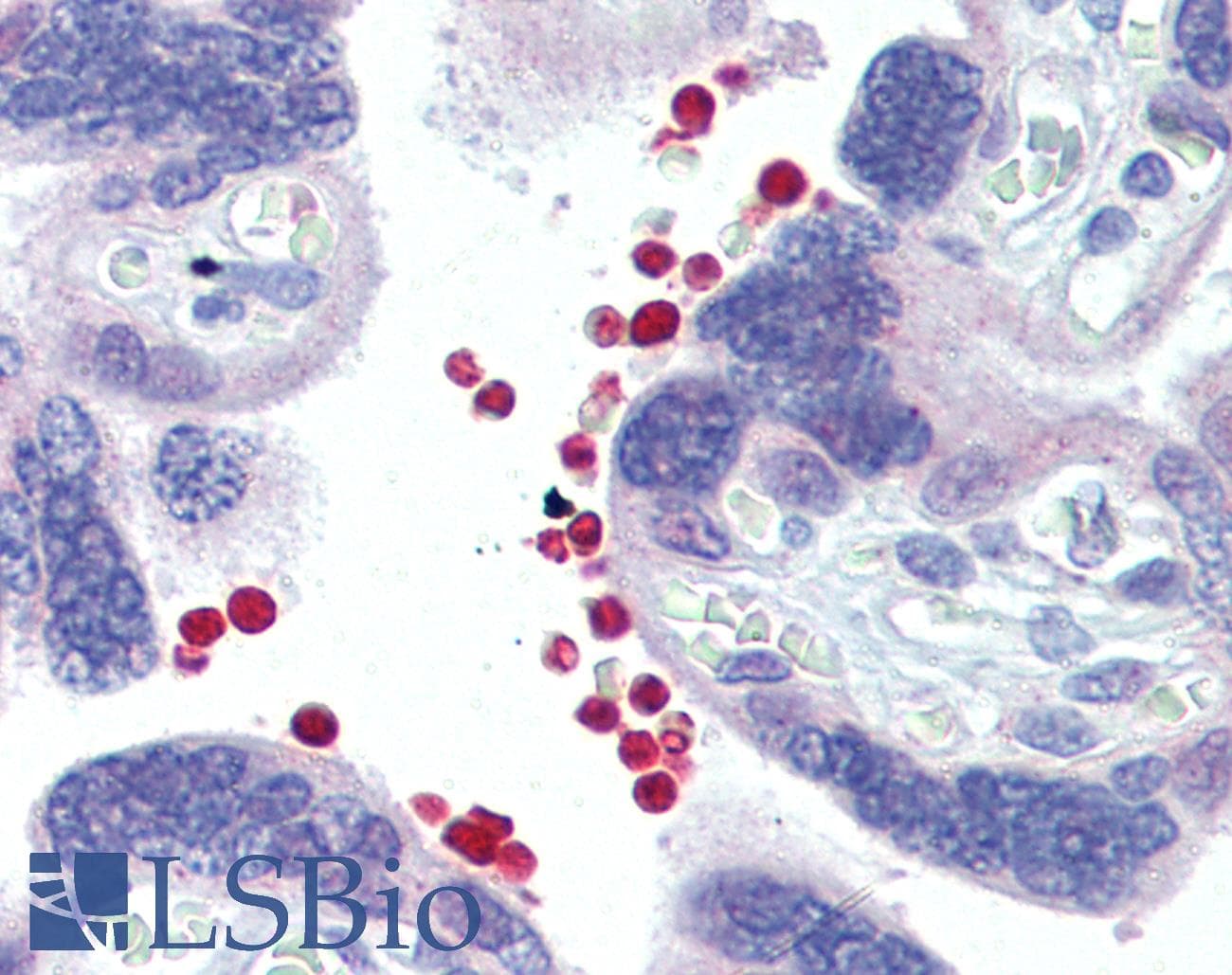 IHC-plus™ Polyclonal Rabbit anti-Human AKT1 + AKT2 Antibody (IHC, WB)