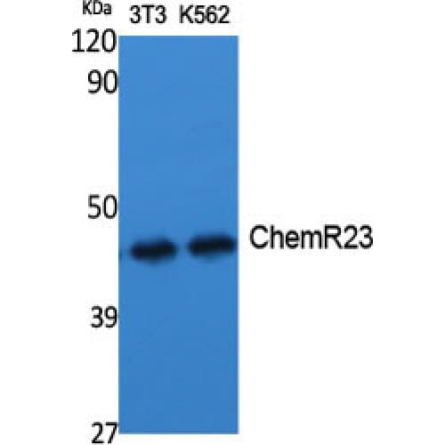 CHEMR23 / CMKLR1 Antibody (190-270 aa, Internal)