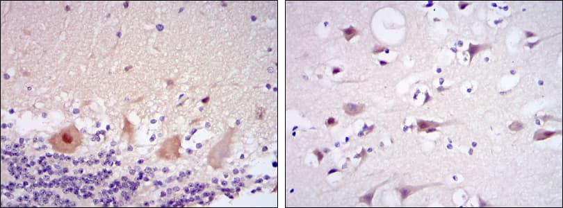 CDK5 Antibody (clone 4E4)