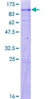 Human ACSL4 / FACL4 Protein (Recombinant GST)