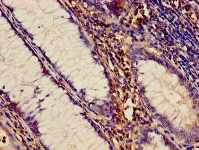 Polyclonal Rabbit anti-Human ADAM10 Antibody (IHC)