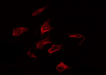 Polyclonal Rabbit anti-Human RAF1 / RAF Antibody (phospho-Ser259, IHC, IF, WB)