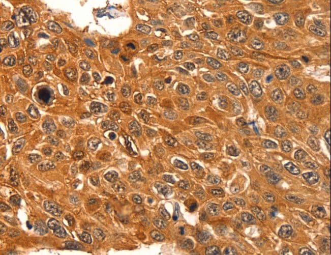 SERPINB5 / Maspin Antibody