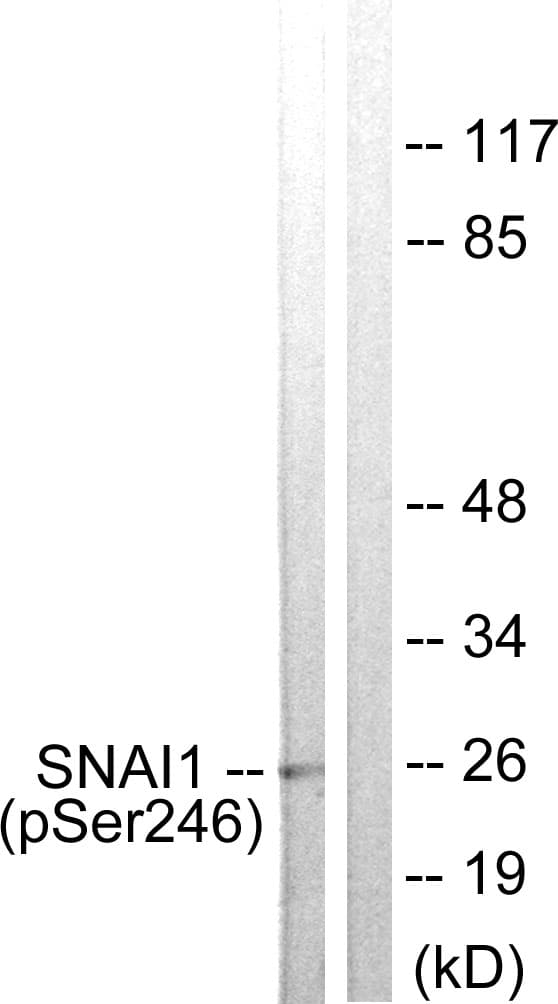 SNAI1 / SNAIL-1 Antibody (phospho-Ser246)