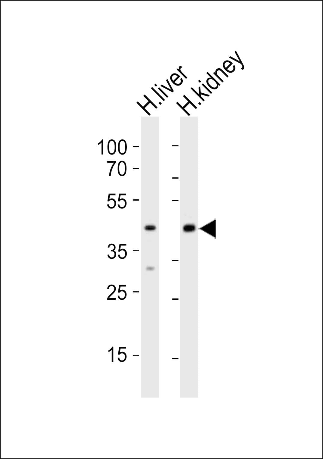 POU5F1B Antibody (aa292-326)