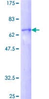 Human DFFA / ICAD / DFF45 Protein (Recombinant GST)