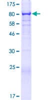 Human UBASH3B / STS-1 Protein (Recombinant GST)