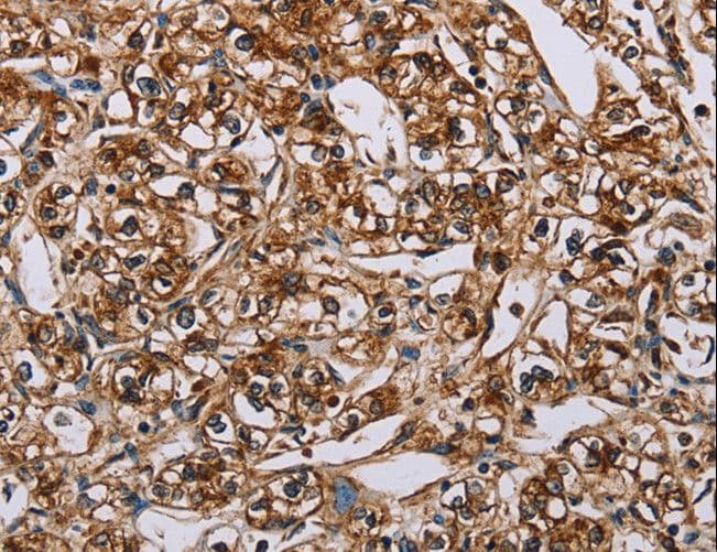 BMP6 Antibody