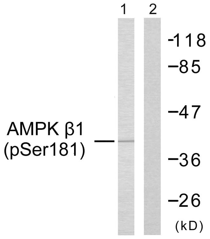 Polyclonal Rabbit anti-Human PRKAB1 / AMPK Beta 1 Antibody (phospho-Ser181, IHC, WB)