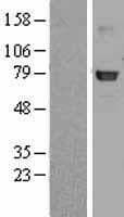 Human GLB1 / Beta-Galactosidase Protein (Over-Expression Lysate Myc-DDK (Flag))