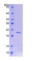 Human CALML5 Protein (Recombinant His-T7)