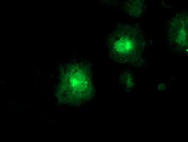 FDFT1 / Squalene Synthase Antibody (clone OTI1H9)