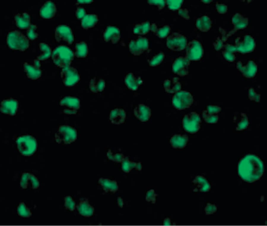 IHC-plus™ ICSBP / IRF8 Antibody
