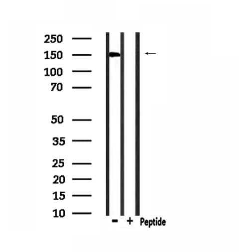 Polyclonal Rabbit anti-Human SLK Antibody (IHC, IF, WB)