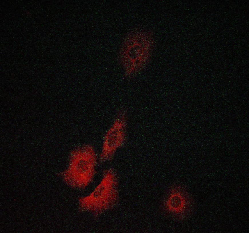TK1 / TK / Thymidine Kinase Antibody