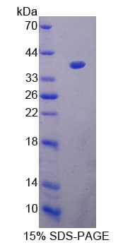 Human PADI3 Protein (Recombinant His-T7)