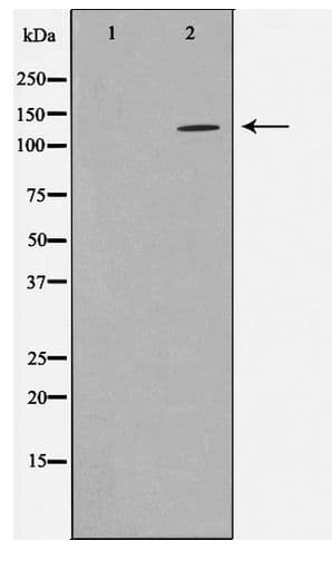 Polyclonal Rabbit anti-Human HDAC5 Antibody (IHC, IF, WB)