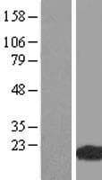 Human WHAMMP3 Protein (Over-Expression Lysate Myc-DDK (Flag))
