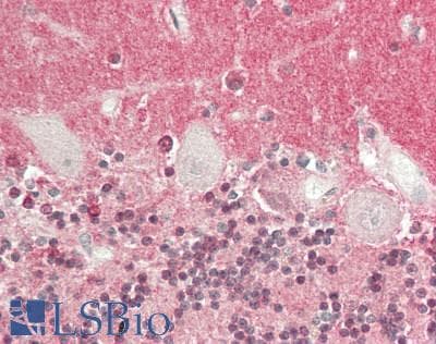 IHC-plus™ GDI1 Antibody
