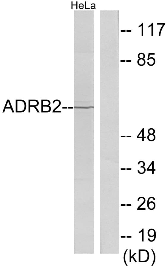 ADRB2 Antibody (aa201-250)