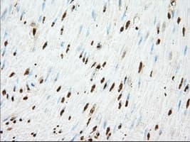 ACAT2 Antibody (clone OTI5F7)