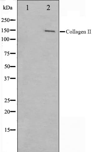 Polyclonal Rabbit anti-Human COL2A1 / Collagen II Alpha 1 Antibody (IHC, IF, WB)