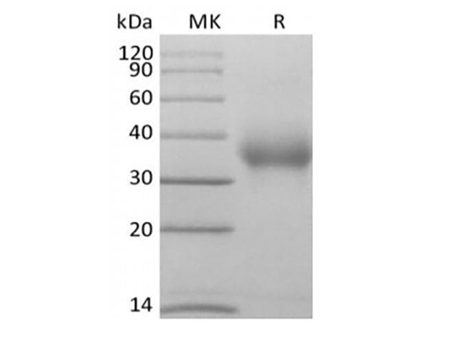 Human CD47 Protein (Recombinant AVI-6His, C-terminus)