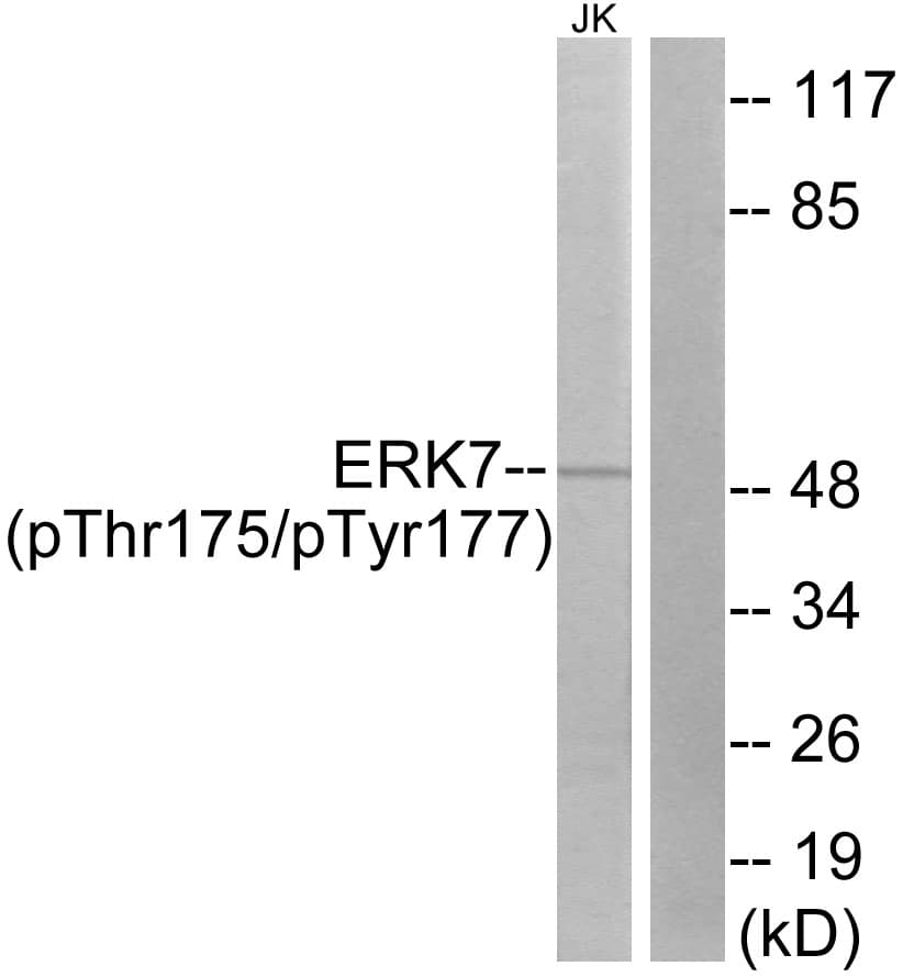 MAPK15 / ERK7 Antibody (phospho-Thr175)