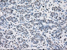 PPP5C Antibody (clone OTI1G2)