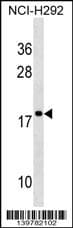 RPS17 / Ribosomal Protein S17 Antibody (aa 77-103, Internal)