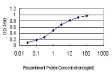 IHC-plus™ CACNB2 Antibody (clone 6C1)
