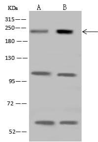 Polyclonal Rabbit anti-Human CDC42BPB / MRCKB Antibody (WB)