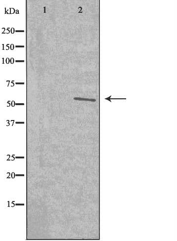 Polyclonal Rabbit anti-Human TMEM145 Antibody (IF, WB)