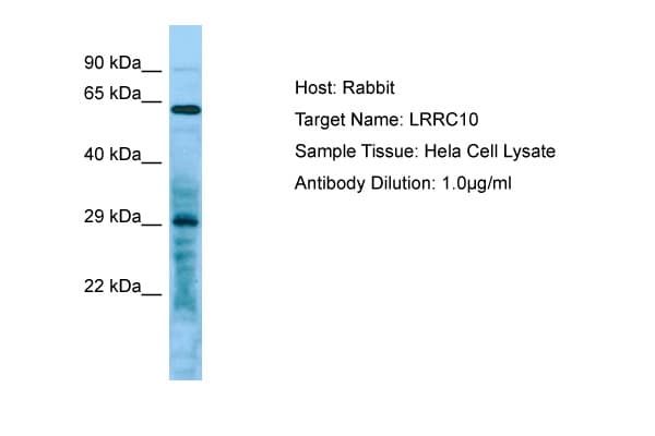LRRC10 Antibody (C-Terminus)