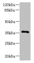 Polyclonal Rabbit anti-Human GIMAP7 Antibody (WB)