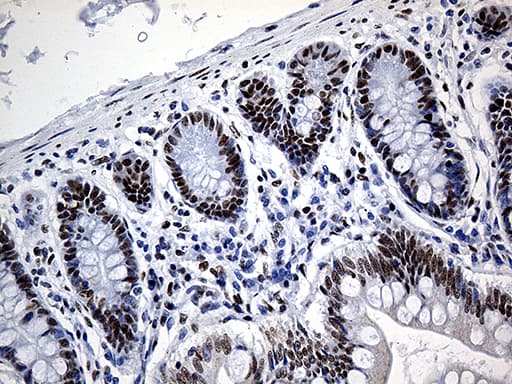 HNRNPH1 / hnRNP H Antibody (clone OTI5D11)