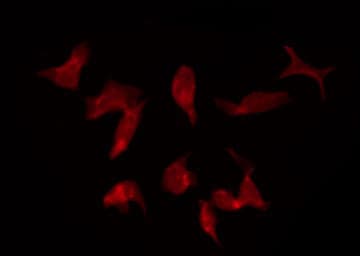 Polyclonal Rabbit anti-Human KCNQ5 Antibody (IF, WB)
