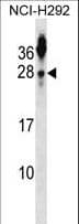TSPAN2 Antibody (aa25-54)