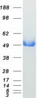 Human ASS1 / ASS Protein (Recombinant Myc-DDK (Flag))